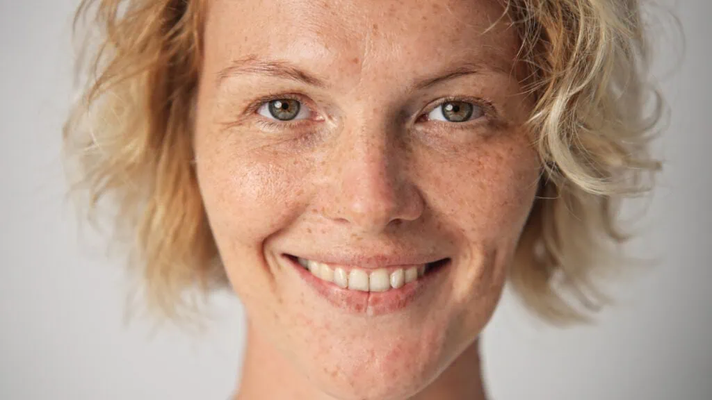 Refractive Lens Exchange (RLE) is a vision correction option for patients who are not good candidates for laser vision correction.